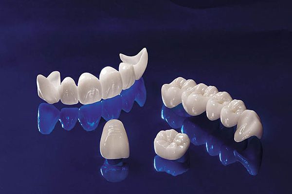 Ưu điểm nổi bật của bọc răng sứ ceramill Zolid