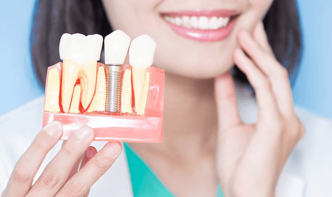 Những hối hận khi trồng implant nên cân nhắc