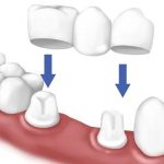 Cách đếm và đọc tên các loại răng đúng cách