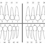 Dịch Vụ Trồng Răng Implant Công Nghệ Đức