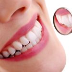 Răng sứ Zirconia có bị ố vàng không? Tìm hiểu ngay!