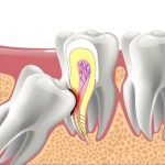 3 Bài tập giảm hô hàm trên