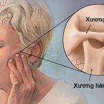 Sai khớp cắn có thể gây hỏng răng không? Tìm hiểu nguyên nhân và cách điều trị