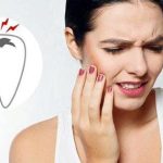 Đau Răng Đau Lên Thái Dương: Nguyên Nhân, Triệu Chứng và Phương Pháp Điều Trị