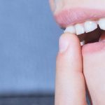 Bọc Răng Sứ Hai Hàm Giá Bao Nhiêu Tiền?