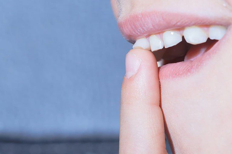 Nguyên Nhân Và Cách Khắc Phục khi răng Sứ Bị Lung Lay