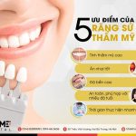 Nguyên Nhân Và Cách Khắc Phục khi răng Sứ Bị Lung Lay