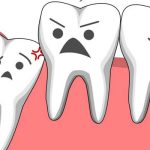 Mọc răng khôn nổi hạch cổ: Liệu có đáng lo ngại?