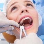 Sau khi nhổ răng bao lâu thì được hút thuốc?