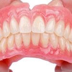 Răng nanh mọc lệch: Nguyên nhân, tác hại và cách khắc phục
