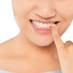 Nhổ răng khôn xong có quan hệ được không?