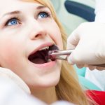 Nguyên nhân nhổ răng số 8 không cầm được máu