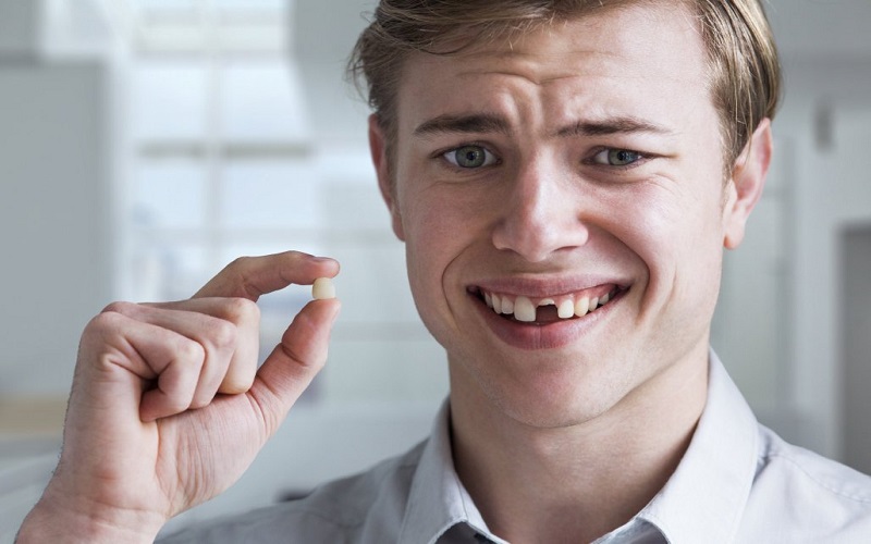 48 Tuổi Bị Rụng Răng Là Do Đâu?