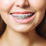 Con gái cười hở lợi: Bí ẩn tướng số và sự thật ít ai biết!