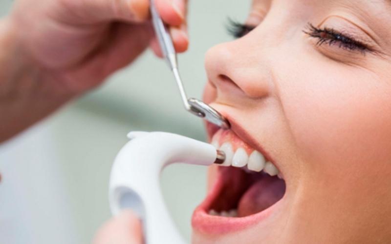 Nguyên nhân gây Lợi trùm răng cửa và hướng khắc phục hiệu quả