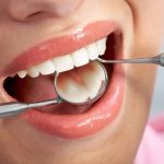 Top 8 địa chỉ phòng khám răng ở Hà Nội tốt, uy tín