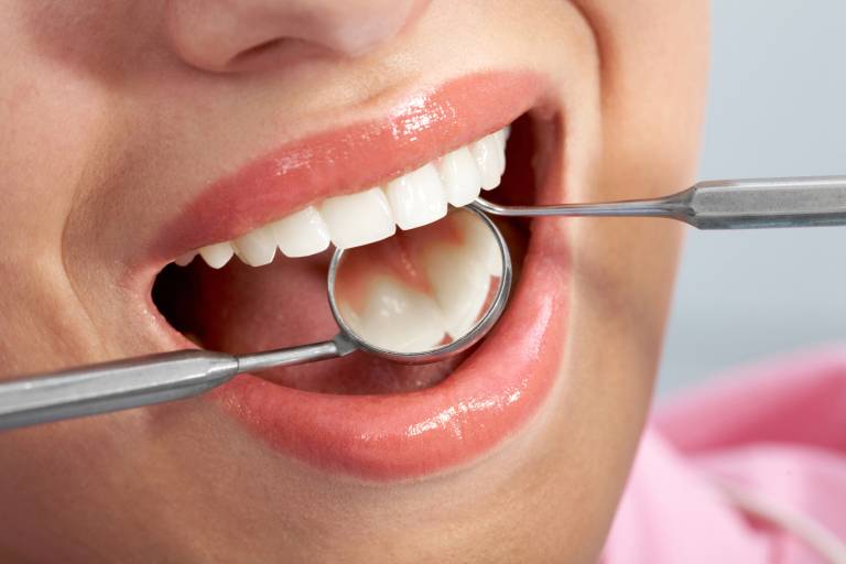 Địa chỉ điều trị viêm nha chu nào uy tín?