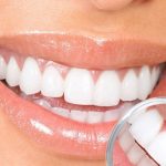 Xét nghiệm máu nhổ răng khôn bao nhiêu tiền?