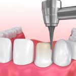 Trẻ sốt mọc răng xong phát ban: Nguyên nhân và cách khắc phục tại nhà
