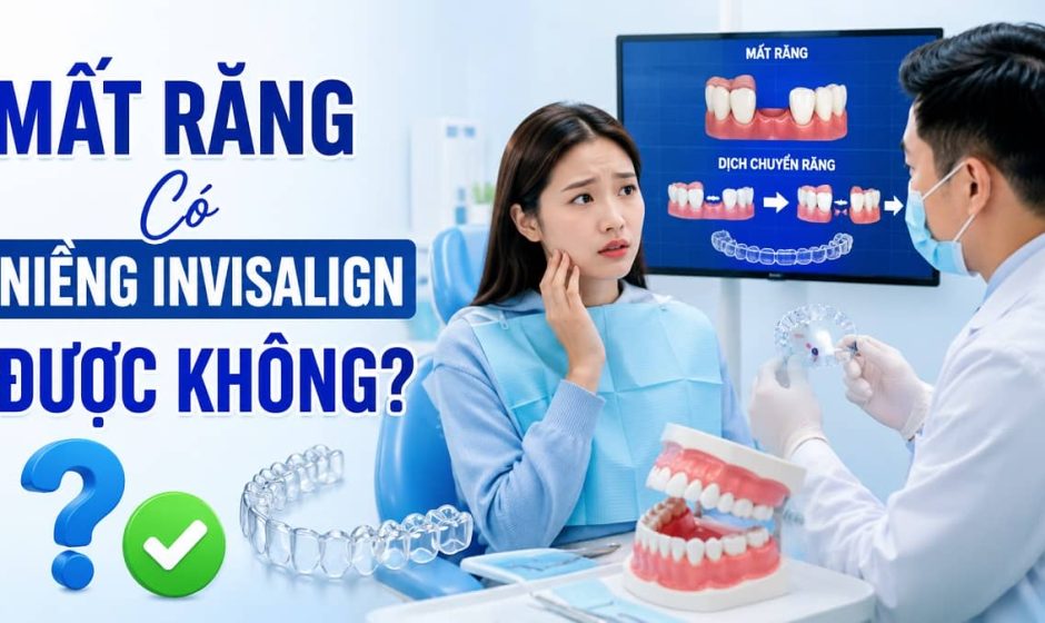 Mất Răng Có Niềng Invisalign Được Không? Giải Đáp Chi Tiết