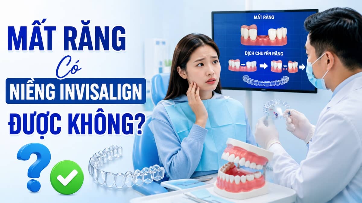 Mất Răng Có Niềng Invisalign Được Không? Giải Đáp Chi Tiết