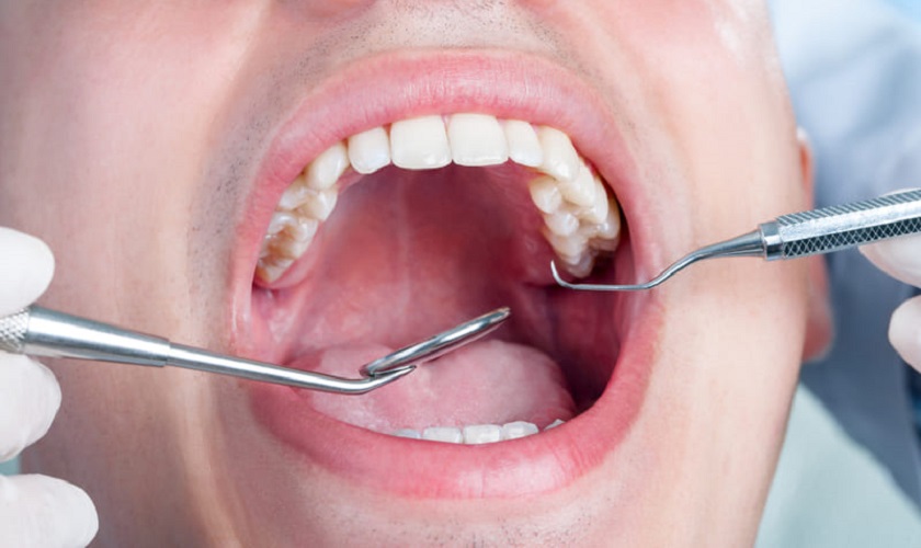 Nhổ răng số 8 có bị xô hàm không? Giải đáp từ bác sĩ